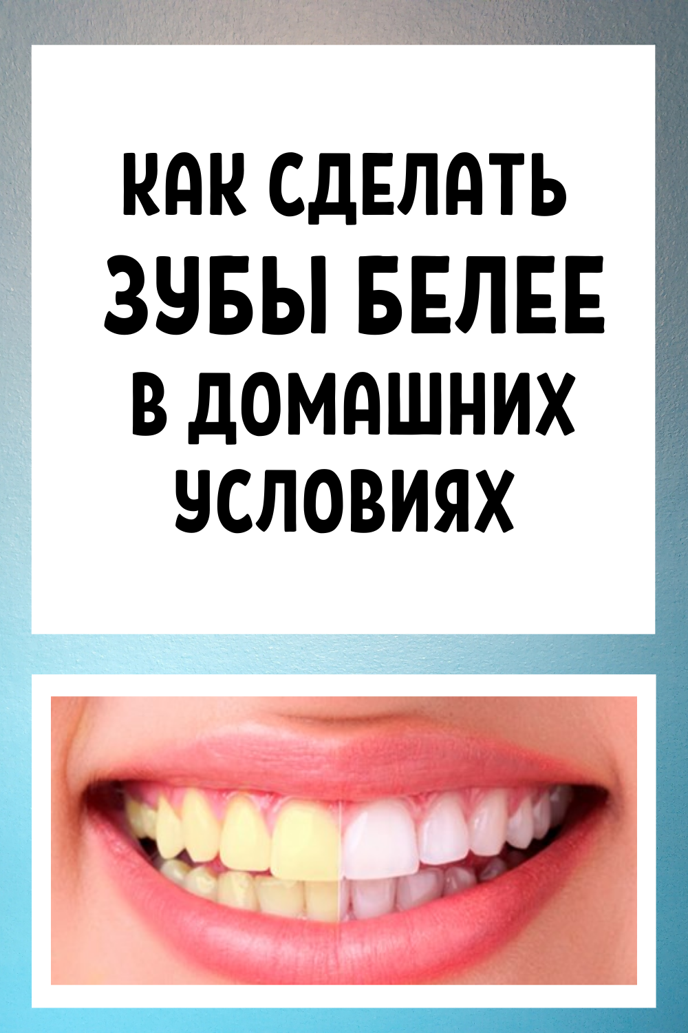 Як відбілити зуби в домашніх умовах швидко